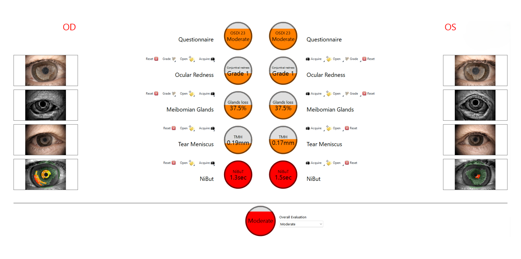 Diagram Of Dry Eye Conditions And Treatment Options