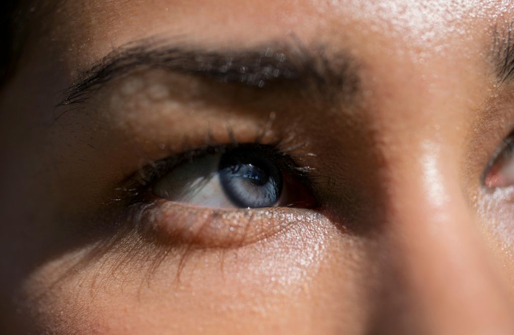 Ocular Rosacea Symptoms: Signs You Should Not Ignore